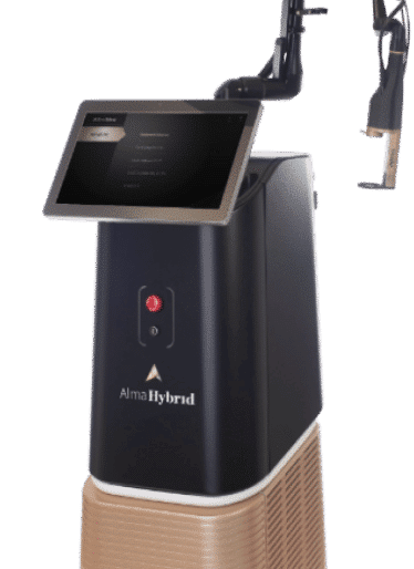Alma hybrid