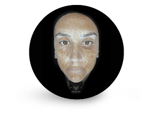 Pigmentation filter