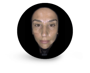 parallel-polarized-Filters