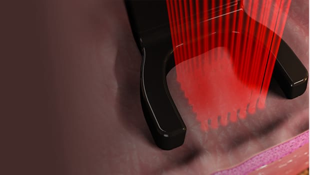 Bio-Stimulation & Lasers: The Science Behind Harmony Bio-Boost